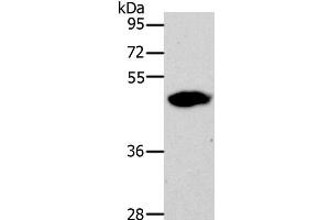 Western Blot analysis of 293T cell using LOX Polyclonal Antibody at dilution of 1:500 (LOX anticorps)