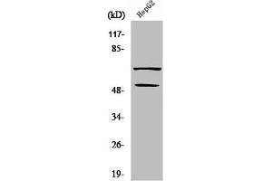 Western Blot analysis of COLO205 cells using SYT Polyclonal Antibody (SS18 anticorps  (N-Term))