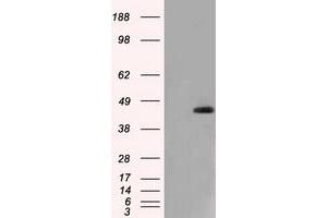 anti-Nucleoredoxin-Like 2 (NXNL2) antibody