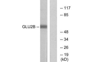Western Blotting (WB) image for anti-Protein Kinase C Substrate 80K-H (PRKCSH) (Internal Region) antibody (ABIN1849168)