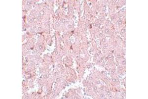 Immunohistochemical staining of rat liver tissue with NR1H3 polyclonal antibody  at 5 ug/mL dilution.