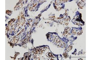 Immunoperoxidase of monoclonal antibody to DKK1 on formalin-fixed paraffin-embedded human placenta. (DKK1 anticorps  (AA 1-266))