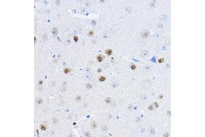 Immunohistochemistry of paraffin-embedded mouse brain using RPP25 Rabbit pAb (ABIN6133248, ABIN6147176, ABIN6147177 and ABIN6225317) at dilution of 1:100 (40x lens). (RPP25 anticorps  (AA 1-199))