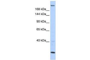 TNRC6B antibody used at 1 ug/ml to detect target protein. (TNRC6B anticorps  (N-Term))