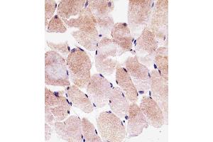 Immunohistochemical analysis of paraffin-embedded H. (SLC25A25 anticorps  (N-Term))