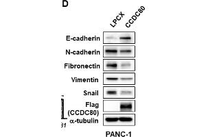 Ectopic expression of CCDC80 reducing migration, colony formation, and EMT in pancreatic cancer cells. (CCDC80 anticorps  (AA 201-300))