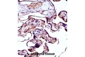 Immunohistochemistry (IHC) image for anti-Neural Precursor Cell Expressed, Developmentally Down-Regulated 9 (NEDD9) antibody (ABIN2998097) (NEDD9 anticorps)