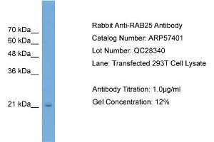 WB Suggested Anti-RAB25  Antibody Titration: 0. (RAB25 anticorps  (Middle Region))