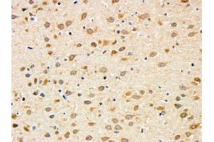 ABIN5539690 (5ug/ml) staining of paraffin embedded Rat Cerebral Cortex. (BDNF anticorps  (Internal Region))