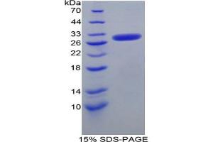 SDS-PAGE analysis of Mouse Nucleoporin 50 kDa Protein. (NUP50 Protéine)