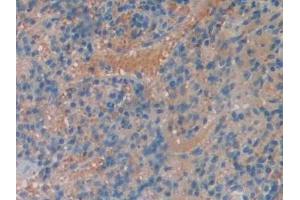 Detection of MAOA in Mouse Spleen Tissue using Polyclonal Antibody to Monoamine Oxidase A (MAOA)