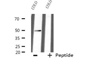 Western blot analysis of extracts from HepG2 cells, using AZI2 antibody. (AZI2 anticorps  (N-Term))