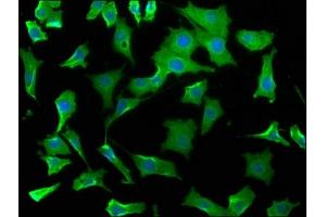 Immunofluorescence staining of SH-SY5Y cells with ABIN7175790 at 1:50, counter-stained with DAPI.