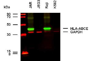 anti-HLA-A+B+C+E antibody