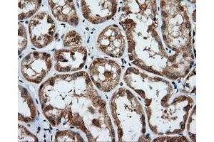 Immunohistochemical staining of paraffin-embedded Kidney tissue using anti-PSMC3 mouse monoclonal antibody. (PSMC3 anticorps)