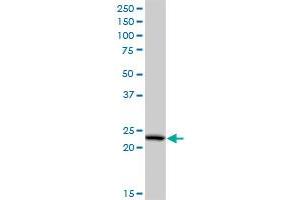 PCTP monoclonal antibody (M03A), clone 3A11. (PCTP anticorps  (AA 106-214))