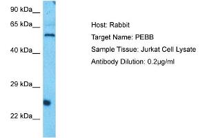 Host: Rabbit Target Name: PEBB Sample Type: Jurkat Whole Cell lysates Antibody Dilution: 0. (CBFB anticorps  (N-Term))