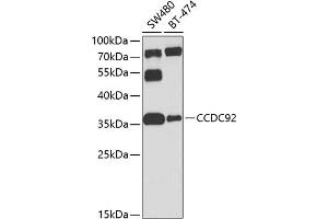 Western blot analysis of extracts of various cell lines, using CCDC92 antibody (ABIN6133294, ABIN6138046, ABIN6138047 and ABIN6224277) at 1:1000 dilution.
