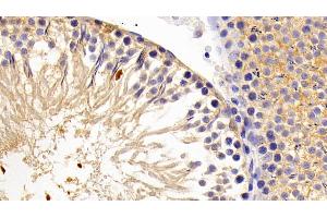 Detection of LPIN1 in Rat Testis Tissue using Polyclonal Antibody to Lipin 1 (LPIN1)