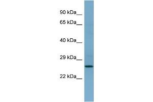 WB Suggested Anti-APIP Antibody Titration: 0. (APIP anticorps  (Middle Region))