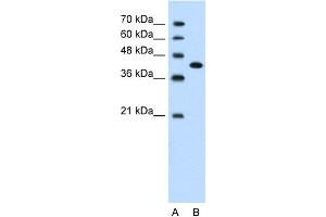 WB Suggested Anti-CEACAM6 Antibody Titration:  1. (CEACAM6 anticorps  (Middle Region))