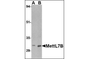 Western blot analysis of MettL7B in rat spleen tissue lysate with this product at (A) 2 and (B) 4 μg/ml. (METTL7B anticorps  (C-Term))