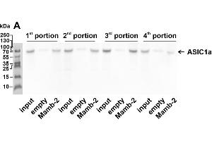 Whole membranes used for the analysis of the molecular targets extracted by mambalgin-2 from membrane fraction of A549 cells.