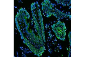 IF analysis of Cytokeratin 19 using anti-Cytokeratin 19 antibody (ABIN3043288).