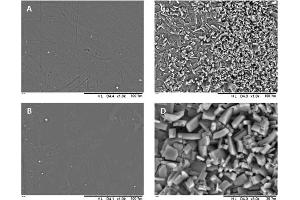 SEM images of the surface of 3D-printed tubular grafts: blank (A), 5 % (w/w) ASA (B), 10 % (w/w) ASA (C), Higher magnification of 10 % (w/w) ASA (D).