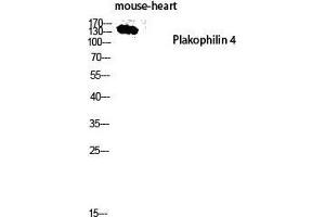Western Blot (WB) analysis of Mouse Heart lysis using Plakophilin 4 antibody. (Plakophilin 4 anticorps  (Internal Region))