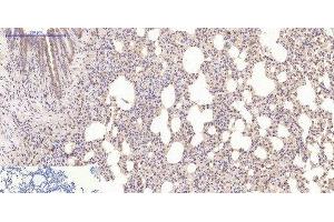 Immunohistochemistry of paraffin-embedded Mouse lung tissue using Desmin Monoclonal Antibody at dilution of 1:200.