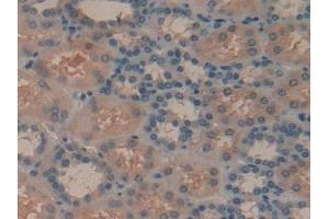 Detection of SYK in Human Kidney Tissue using Polyclonal Antibody to Spleen Tyrosine Kinase (SYK)