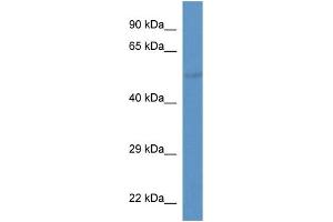 WB Suggested Anti-Slc37a2 Antibody   Titration: 1. (SLC37A2 anticorps  (Middle Region))