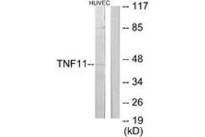 Western blot analysis of extracts from HuvEc cells, using TNFSF11 Antibody. (RANKL anticorps  (AA 41-90))