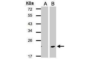 WB Image Western Blot analysis of DPT expression in transfected 293T cell line by DPT polyclonal antibody. (Dermatopontin anticorps)