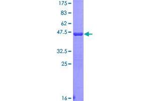 Image no. 1 for Ribosomal Protein SA (RPSA) (AA 196-295) protein (GST tag) (ABIN1318866)