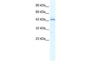 Western Blotting (WB) image for anti-SP140 Nuclear Body Protein-Like (SP140L) antibody (ABIN2461297) (SP140L anticorps)