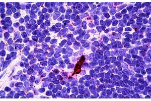 Human Lyphoid-Dendritic Cells: Formalin-Fixed, Paraffin-Embedded (FFPE) (EBI3 anticorps)