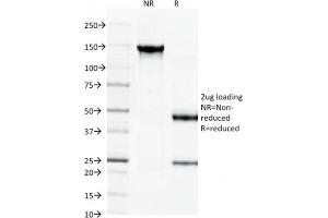 SDS-PAGE Analysis Purified Spectrin beta III Monoclonal Antibody (SPTBN2/1584).