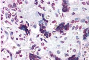 Human Placenta: Formalin-Fixed, Paraffin-Embedded (FFPE) (CARD14 anticorps  (C-Term))