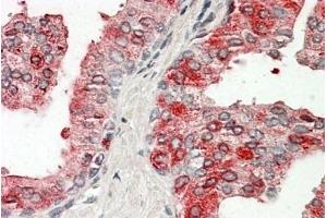 anti-Acid Phosphatase, Prostate (ACPP) (Internal Region) antibody