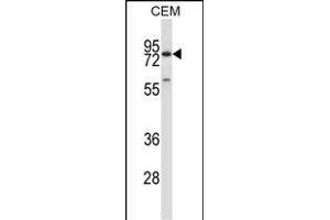 P16 Antibody (C-term) (ABIN657636 and ABIN2846632) western blot analysis in CEM cell line lysates (35 μg/lane). (MMP16 anticorps  (C-Term))