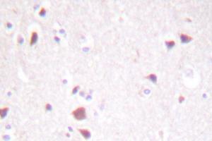 Image no. 1 for anti-Macrophage Stimulating 1 (Hepatocyte Growth Factor-Like) (MST1) antibody (ABIN272039)