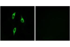 Immunofluorescence analysis of LOVO cells, using OR51B2 Antibody. (OR51B2 anticorps  (AA 196-245))