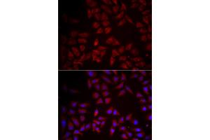 Immunofluorescence analysis of HeLa cells using CCL25 antibody. (CCL25 anticorps)