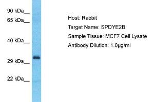Host: Rabbit Target Name: SPDYE2B Sample Type: MCF7 Whole Cell lysates Antibody Dilution: 1. (SPDYE2B anticorps  (C-Term))