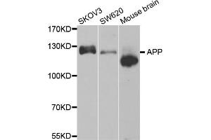 Western blot analysis of extracts of various cell lines, using APP antibody (ABIN5971616). (APP anticorps)