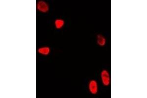 Immunofluorescent analysis of WDR5 staining in U2OS cells. (WDR5 anticorps)