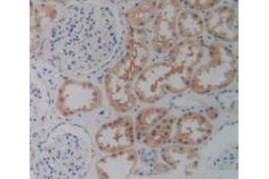 IHC-P analysis of Human Kidney Tissue, with DAB staining. (P2RX7 anticorps  (AA 47-334))