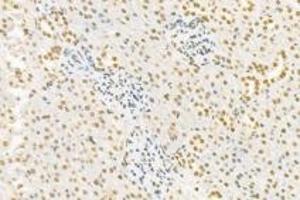 Immunohistochemistry analysis of paraffin-embedded rat kidney using,PNN (ABIN7075083) at dilution of 1: 1200
